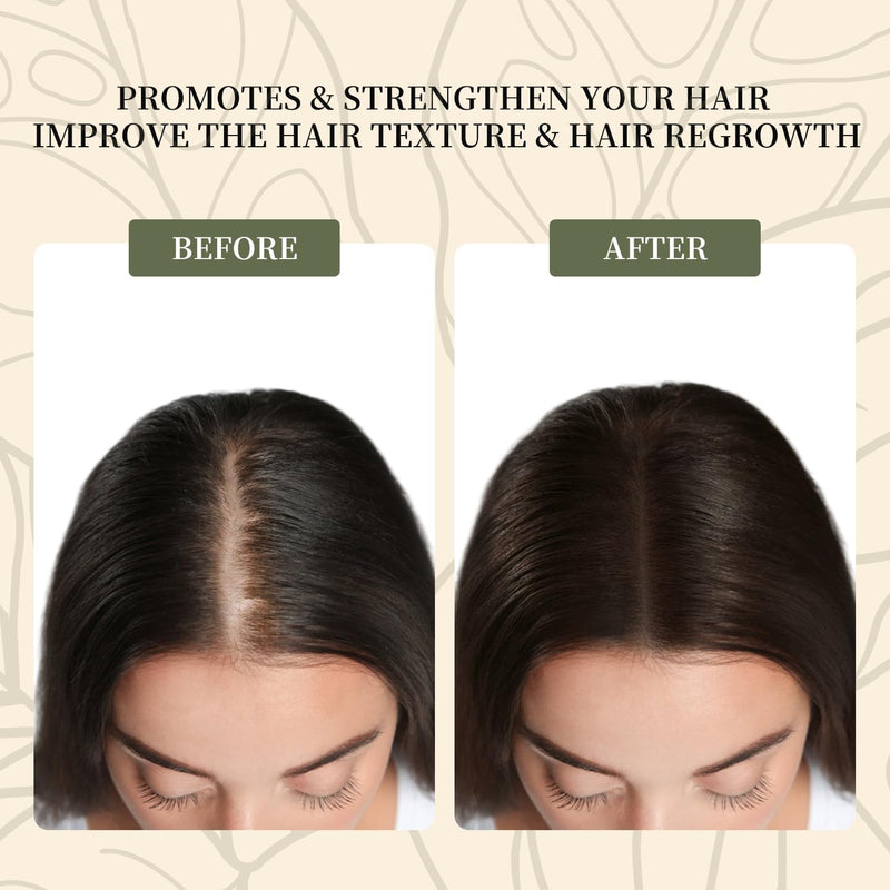 Batana Oil for Hair Growth,100% Pure & Natural Raw Batana Oil, Dr. Sebi Organic from Honduras,Care for Hair Thickness,Scalp&Skin,4.23 fl oz,1 Bottle with 2 Caps