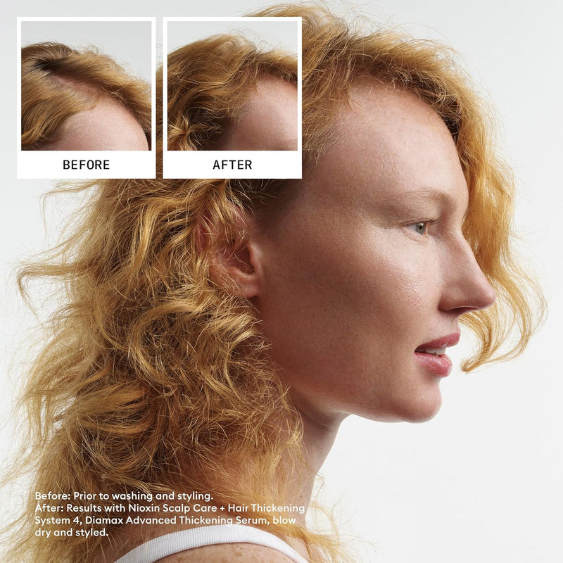 Nioxin Scalp + Hair Thickening System Kits | For Natural, Colored, & Damaged Hair with Light to Progressed Thinning | Strengthen & Boost Hair Density with Niacinamide & Biotin | 1 Month Supply